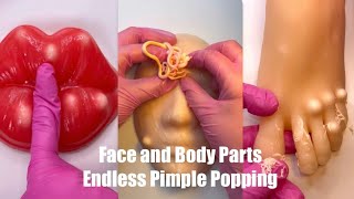 Endless Pimple Popping Satisfying ASMR on Squishy Face and Body [upl. by Amasa]