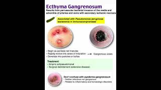 Ecthyma gangrenosum [upl. by Van174]