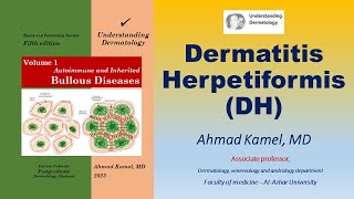 Dermatitis Herpetiformis DH [upl. by Kayne]