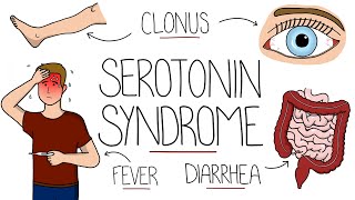 Serotonin Syndrome Explained Serotonin Toxicity [upl. by Annoid]