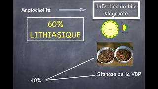 Lithiase Biliaire  4 Angiocholite [upl. by Nosille]