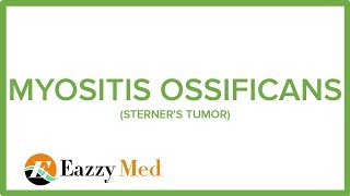 MYOSITIS OSSIFICANS STERNERS TUMOR [upl. by Jerrol283]