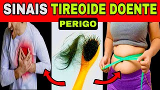 7 SINAIS INICIAIS de TIREOIDE DOENTE Primeiros Sintomas de Hipotireoidismo e Hipertireoidismo [upl. by Yevette456]