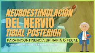 👌 Neuroestimulación del nervio TIBIAL POSTERIOR para INCONTINENCIA URINARIA o FECAL [upl. by Lumbard]