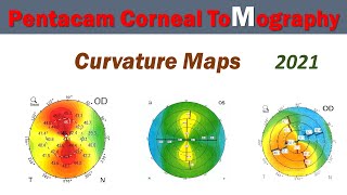 Pentacam Corneal Topography Curvature Maps 018 [upl. by Irakab]