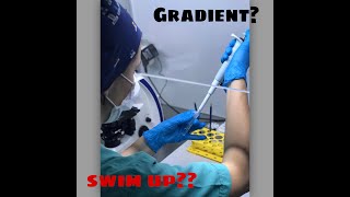 Sperm hazırlama Gradient vs Swim up [upl. by Jepson]