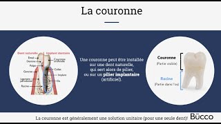 Les prothèses dentaires  TV de Salle dattente Dentiste [upl. by Ybbil653]