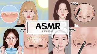 RELAX 10 MIN ASMR Blackhead amp Pimple Popping Animation  Mengs Stop Motion [upl. by Bayer]