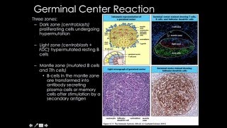 Clonal expansion medullary chords and primary follicle [upl. by Hcir]