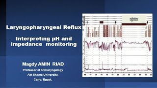 Laryngopharyngeal Reflux  Interpreting pH Impedance monitoring [upl. by Evered296]