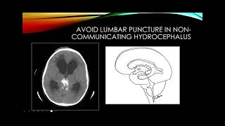 Cerebrospinal fluid [upl. by Osman]