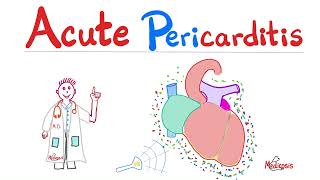 Acute Pericarditis Pericardial Effusions Dressler Syndrome — Cardiology Series [upl. by Doughty]