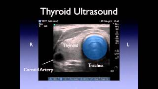 Neck Ultrasound [upl. by Chatterjee]