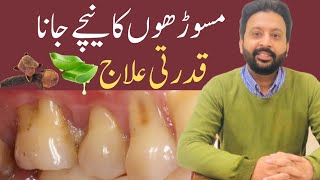 Easy Ways to GROW Receding Gums Back Naturally [upl. by Etsyrk71]