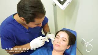 BELOTERO BALANCE® Dermal Filler for Under Eye at ZO Skin Centre [upl. by Lairret]