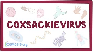 Coxsackievirus  an Osmosis Preview [upl. by Fernandes]