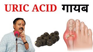 Uric Acid Treatment  Uric acid kaa ilaj Hindi me  Gout [upl. by Sapers145]