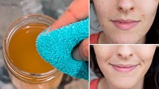 Why You Should Wash Your Face With Apple Cider Vinegar [upl. by Belen]