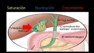 Fisiopatologia de la colelitiasis [upl. by Nylhtiak206]