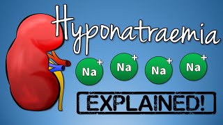 Hyponatremia EXPLAINED with Animation [upl. by Akyeluz]