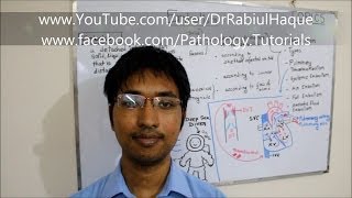 Embolism  Definition Types Pathogenesis Clinical Consequences HD [upl. by Oniskey853]