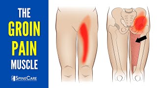 The Groin Pain Muscle How to Release It for INSTANT RELIEF [upl. by Ylehsa]