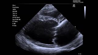 Siemens P500 case example canine mitral regurgitation [upl. by Gridley]