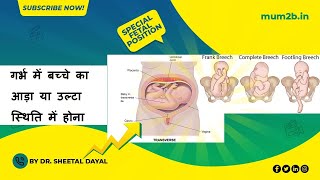 Fetal Positions for Birth  Abnormal Positions in womb  Mum2b [upl. by Dnarud]