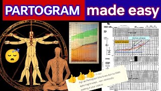 PARTOGRAM ❤️ WHO MODIFIED PARTOGRAM ❤️🙏👍 partogram labour pregnancy mbbs lecture exam [upl. by Kappel515]