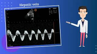 Severe venous congestion on point of care ultrasound  VExUS  POCUS  Dr Koratala NephroP [upl. by Ashmead259]