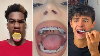 All Your TikTok Dental Pain In One Video [upl. by Giraldo843]