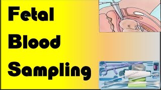 Fetal Blood Sampling [upl. by Dann]