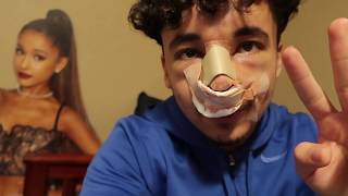 I got a nose job Rhinoplasty Vlog [upl. by Eirlav]