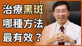 肝斑或黑斑，哪種治療方法最有效？哪種方法最不會復發？ [upl. by Bigner331]