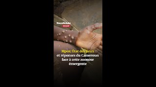 Mpox État des lieux et réponses du Cameroun face à cette zoonose émergente [upl. by Casta591]