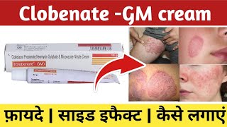 Clobenate gm cream ke fayde  Clobenate gm cream kis kaam aati hai  Clobenate gm cream uses [upl. by Levin]