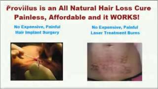 Provillus Review  Edgar Cayce Hair Loss Cure [upl. by Harac]