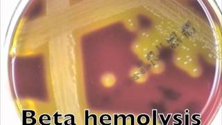 Comparison of hemolysis on blood agarmov [upl. by Emyle530]