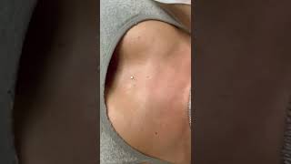 STERNUM MICRODERMAL bodypiercing piercingartist microdermalpiercing piercing piercingstudio [upl. by Enellek646]