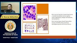 APPROACH TO PATIENTS WITH PANCYTOPENIA MAY 2023 [upl. by Repmek206]