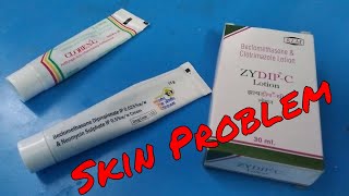 Skin Problem alergy Solution [upl. by Bigg136]