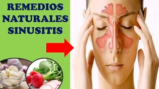 REMEDIOS CASEROS Y NATURALES PARA LA SINUSITIS [upl. by Daggna]