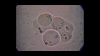 Trichomonas hominis con doble intento de fagocitosis de Blastocystis por un citostoma elástico [upl. by Olecram]