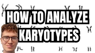 KARYOTYPE ANALYSIS [upl. by Tomlin916]