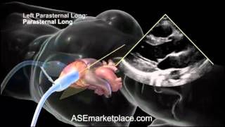 How to do a Basic Transthoracic Echocardiogram Transducer Position and Anatomy [upl. by Esiole891]