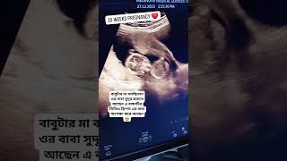 16 Weeks Pregnancy Ultrasonogram  ১৬ সপ্তাহের আলট্রাসোনোগ্রাম কেমন হয় ultrasound pregnancyscan [upl. by Nyltyak]