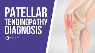 How to Diagnose Patellar Tendinopathy  Jumpers Knee Diagnosis [upl. by Anihsit]