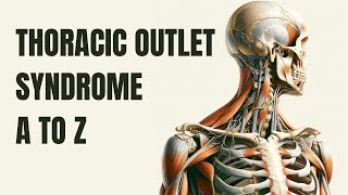 Unraveling Thoracic Outlet Syndrome From Etiology to Informed Treatment Outdated [upl. by Anehc787]