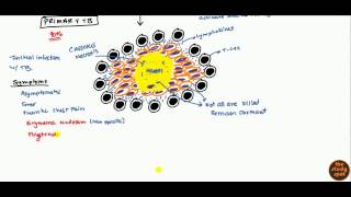 Tuberculosis for USMLE Step 1 and USMLE Step 2 [upl. by Aihseuqram]