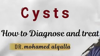 Cyst  How to diagnose and treat [upl. by Amelus94]